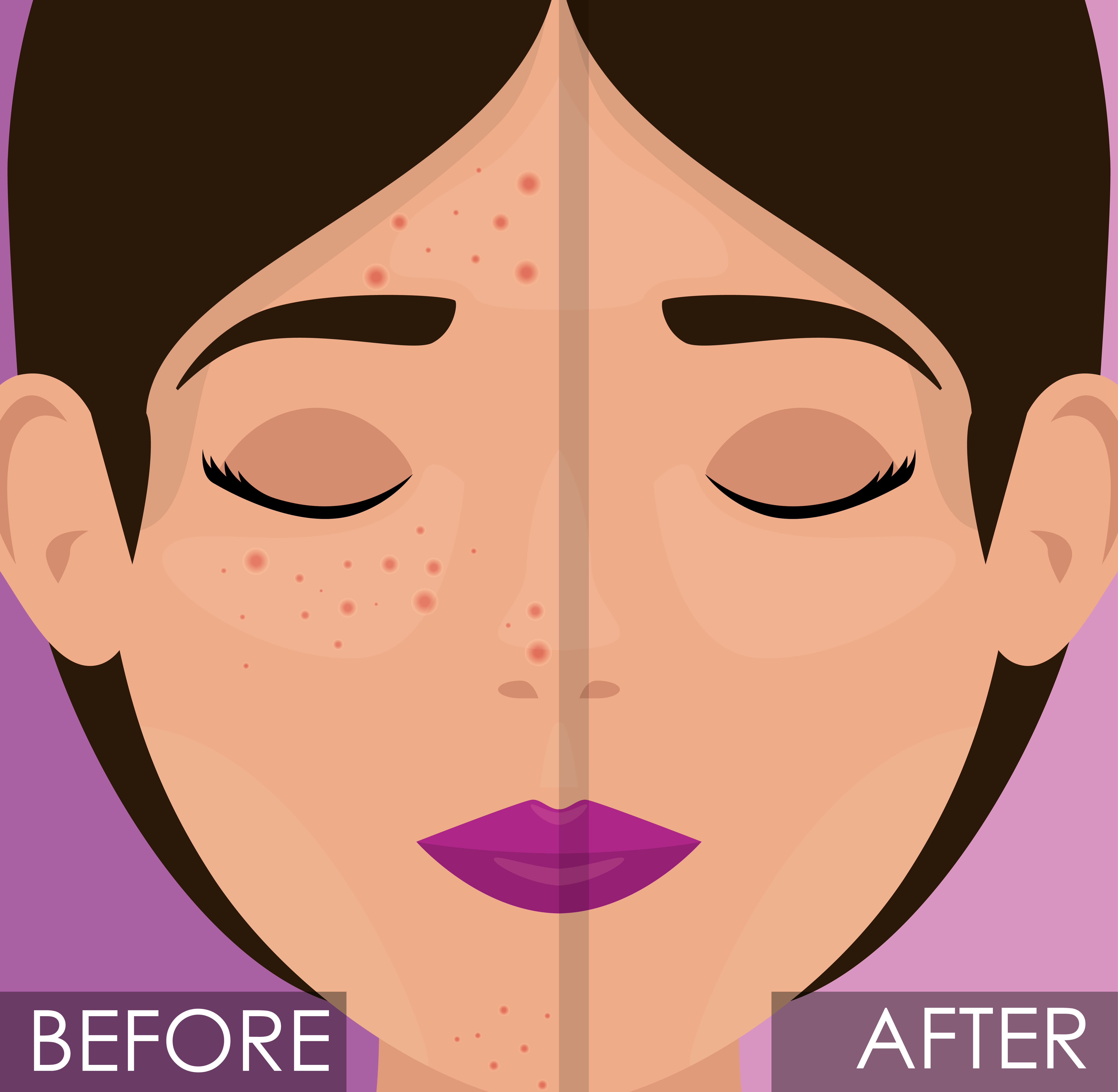 woman before and after skin treatment woman before and after skin treatment vector illustration design